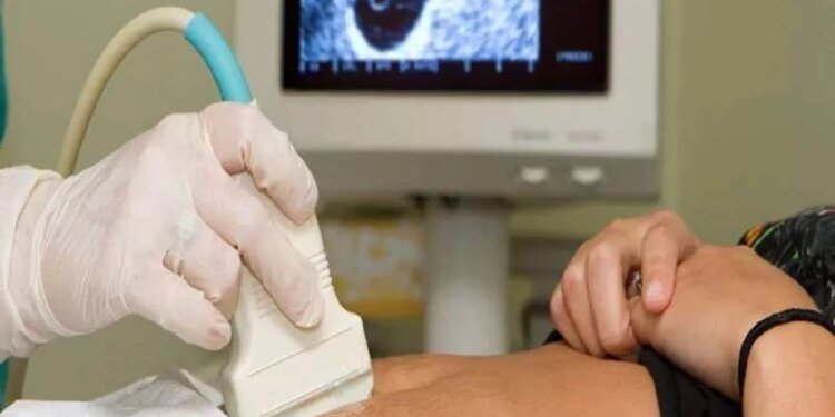 नियमों की अनदेखी पर कड़ी कार्रवाई, भोपाल के दो सोनोग्राफी केंद्रों की मान्यता निरस्त