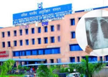 अब एक्स-रे मशीन से मिलेगी सीटी स्कैन जैसी थ्रीडी इमेज, आसान होगा इलाज