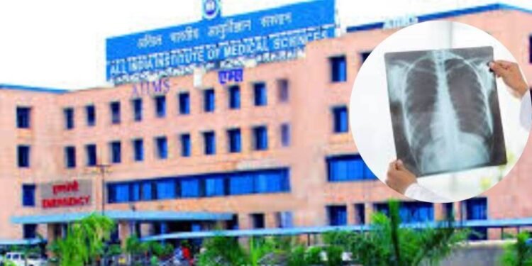 अब एक्स-रे मशीन से मिलेगी सीटी स्कैन जैसी थ्रीडी इमेज, आसान होगा इलाज