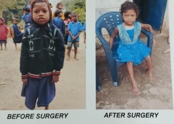 चिरायु एक वरदान : हृदय रोग से पीडित दिव्या ऑपरेशन के बाद जी रही है सामान्य जिन्दगी