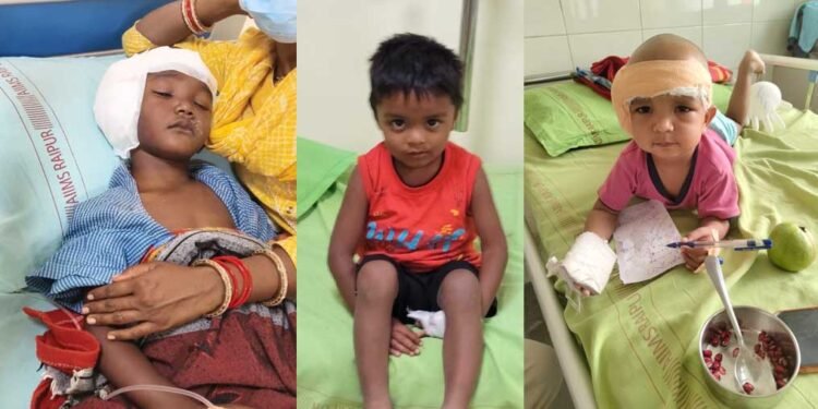 ‘चिरायु’ ने जगाई आस: जन्मजात बधिरता से जूझ रहे3 बच्चों का सफल कॉक्लियर इंप्लांट