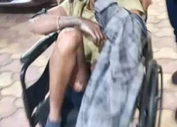 स्पंज आयरन प्लांट में हादसा, पिघला लोहा गिरने से 4 मजदूर झुलसे