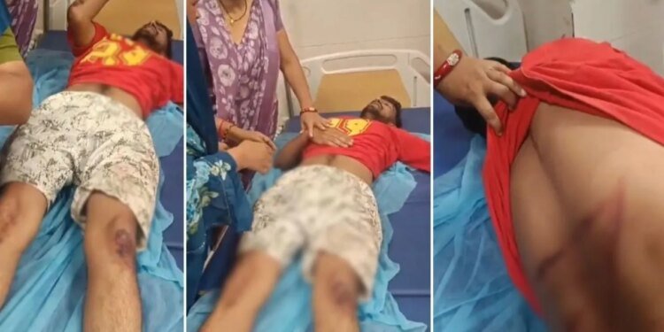 भोपाल में विधायक पुत्र से मारपीट मामले में नया मोड़:आरोपी की मां बोली- थाने में भी मेरे बेटों को पीटा गया