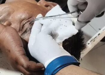200 श्रद्धालुओं की भीड़ पर मधुमक्खियों का हमला, 40 घायल:देवास में एक युवक को 200 डंक लगे; जान बचाने 2 किमी तक भागे लोग